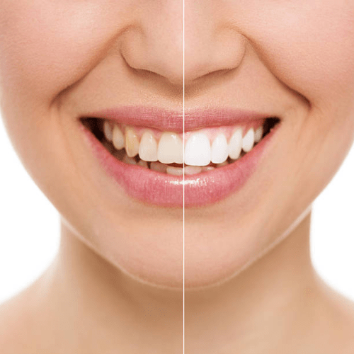 Oral Care