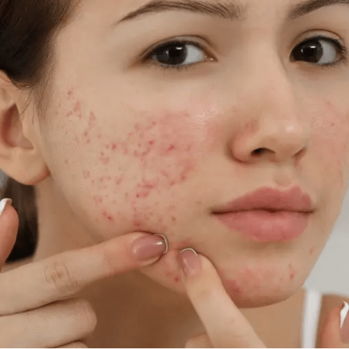 Skincare